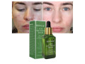 breylee-acne-treatment-serum-price-in-pakistan-wellmart-923208727951-small-0