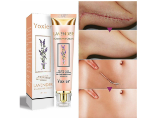 Yoxier Lavender Scar Repair Cream Price In Pakistan Wellmart +923208727951